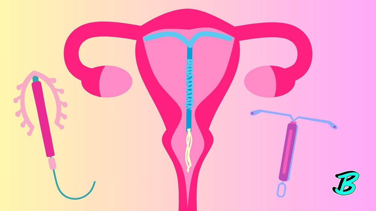 Unlocking the Mysteries of IUDs: A Comprehensive Guide to Understandin ...