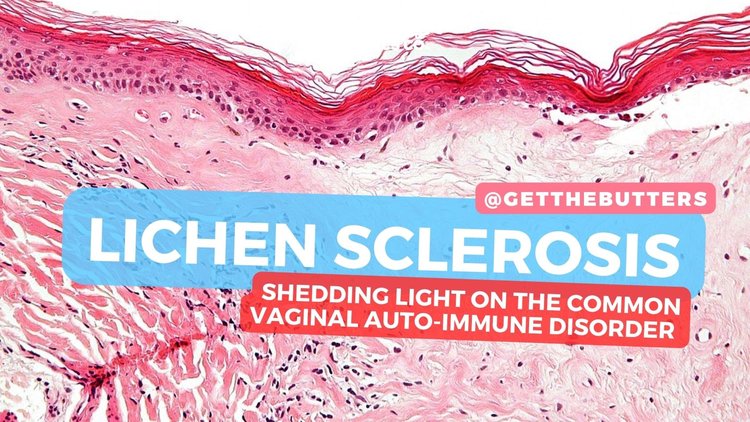 Lichen Sclerosis Understanding This Common Vaginal Auto immune Disord lichen-sclerosis-understanding-this-common-vaginal-auto-immune-disord