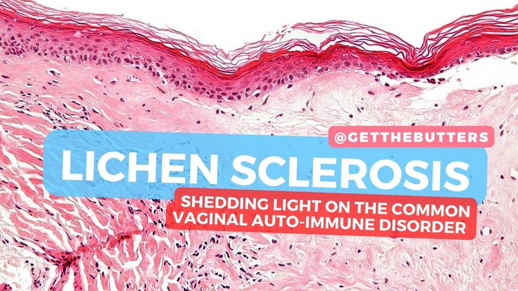 Lichen Sclerosis: Understanding this common vaginal auto-immune disorder (gender neutral)