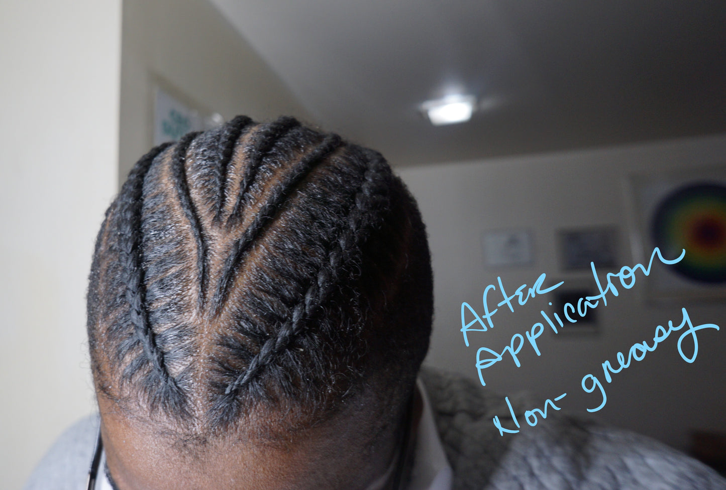 Aceite antipicazón ❌ para el cuero cabelludo: ideal para el cuero cabelludo seco y escamoso